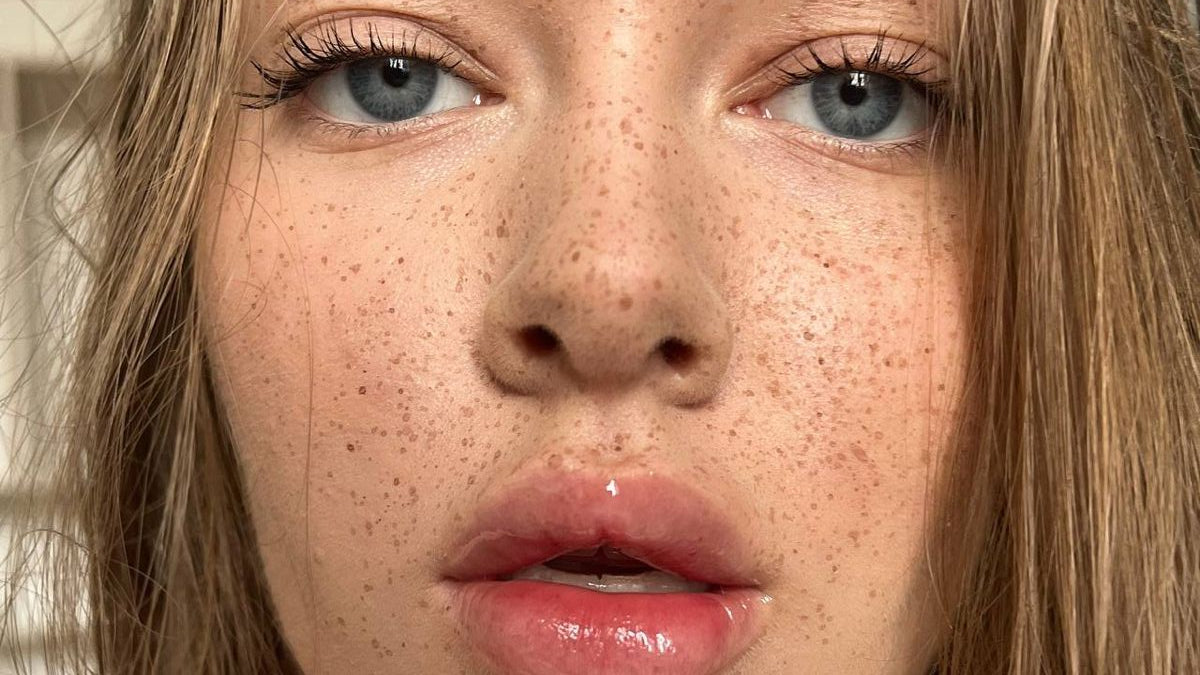 The Difference Between Sunspots and Freckles and How to Care for Each