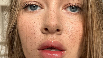 The Difference Between Sunspots and Freckles and How to Care for Each