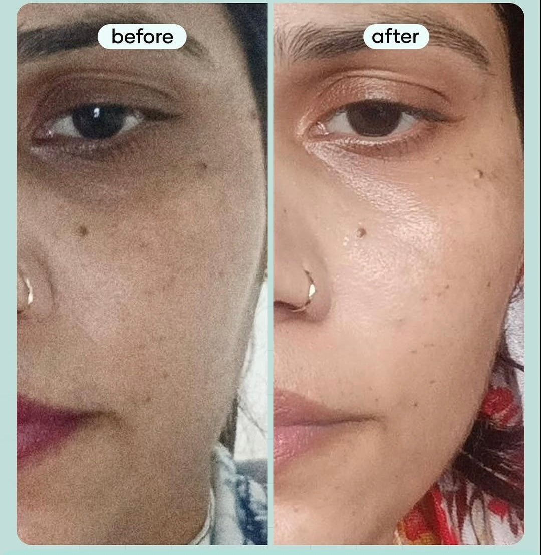 VITAMIN C + NIACINAMIDE BRIGHTENING Kit (PACK OF 4)