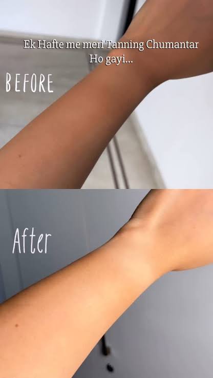 Ornella Glycolic Acid Toner + FREE D-Tan Cleanser