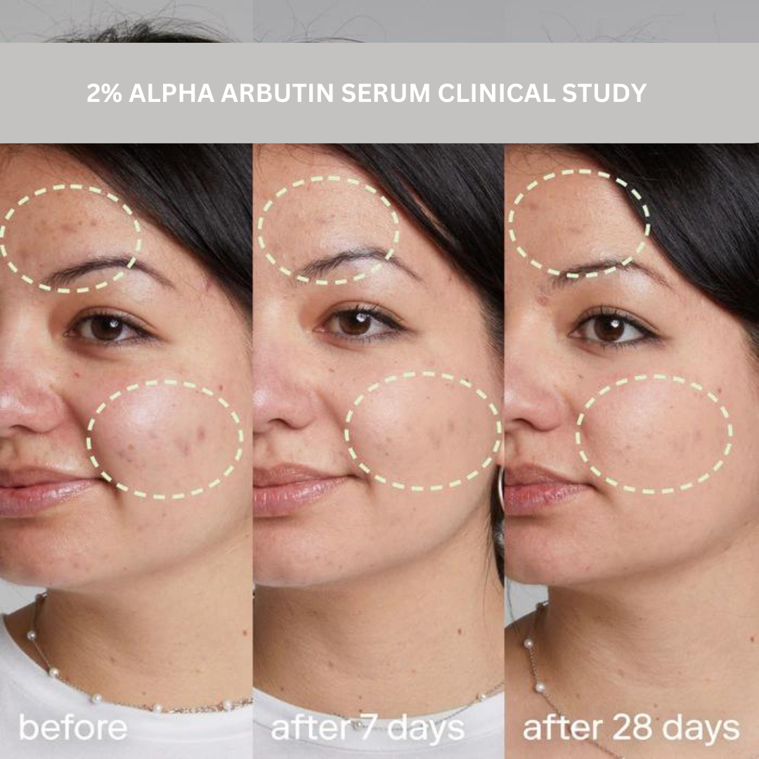 2% ALPHA ARBUTIN ULTRA WHITENING SERUM