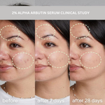 2% ALPHA ARBUTIN WHITENING SERUM (30 ml)