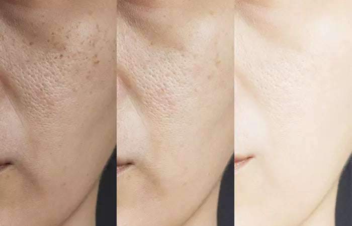 5 % GLYCOLIC ACID + PHA EXFOLIATING TONER (120 ml)