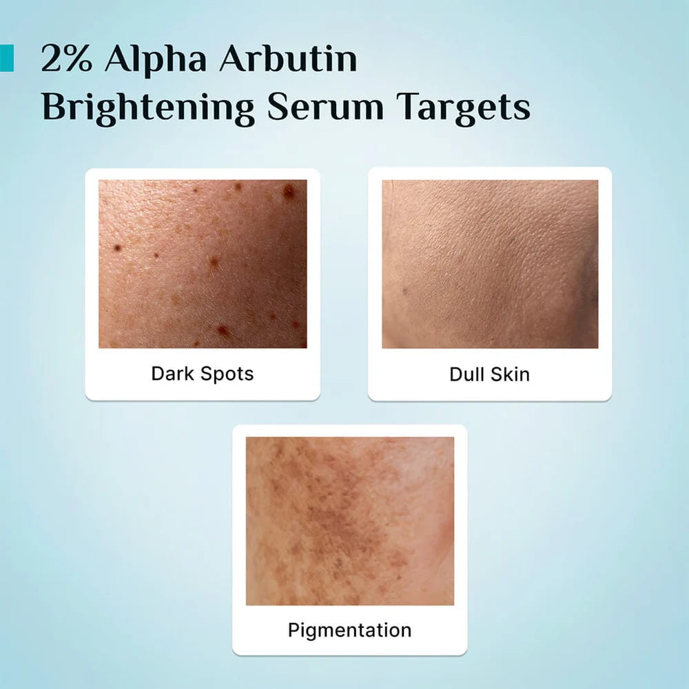 2% ALPHA ARBUTIN WHITENING SERUM (30 ml)