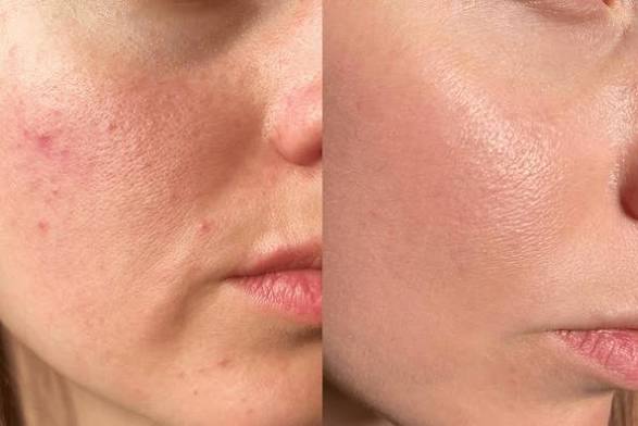 WINTERS SPECIAL BRIGHT & HYDRATE BUNDLE (Pack of 3)