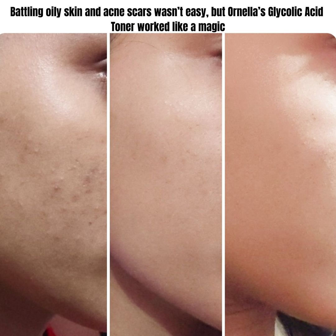 5 % GLYCOLIC ACID + PHA EXFOLIATING TONER (120 ml)