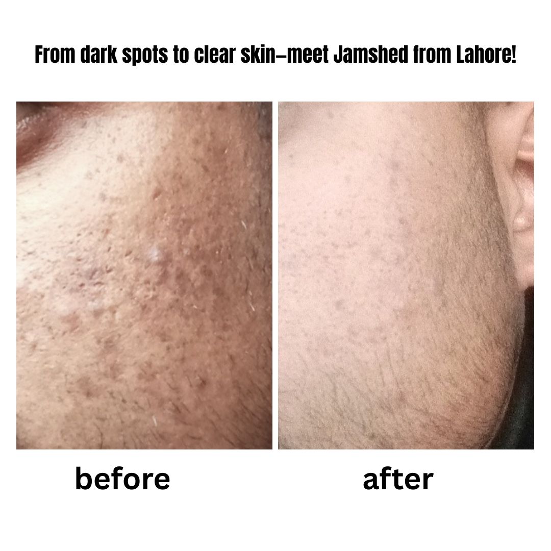 5 % GLYCOLIC ACID + PHA EXFOLIATING TONER (120 ml)