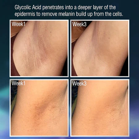 5% GLYCOLIC ACID + STRAWBERRY EXTRACTS EXFOLIATING CLEANSER (120 ml)