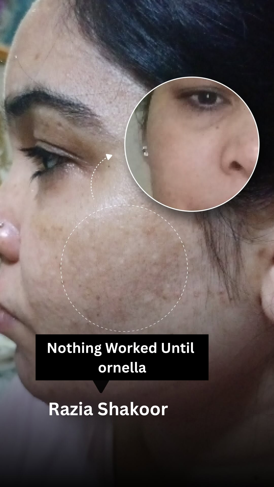 KOREAN GLASS SKIN BUNDLE (PACK OF 5)