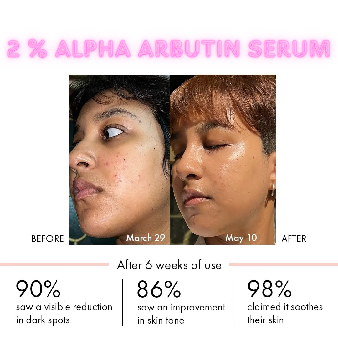 2% ALPHA ARBUTIN ULTRA WHITENING SERUM