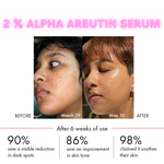 2% ALPHA ARBUTIN WHITENING SERUM (30 ml)