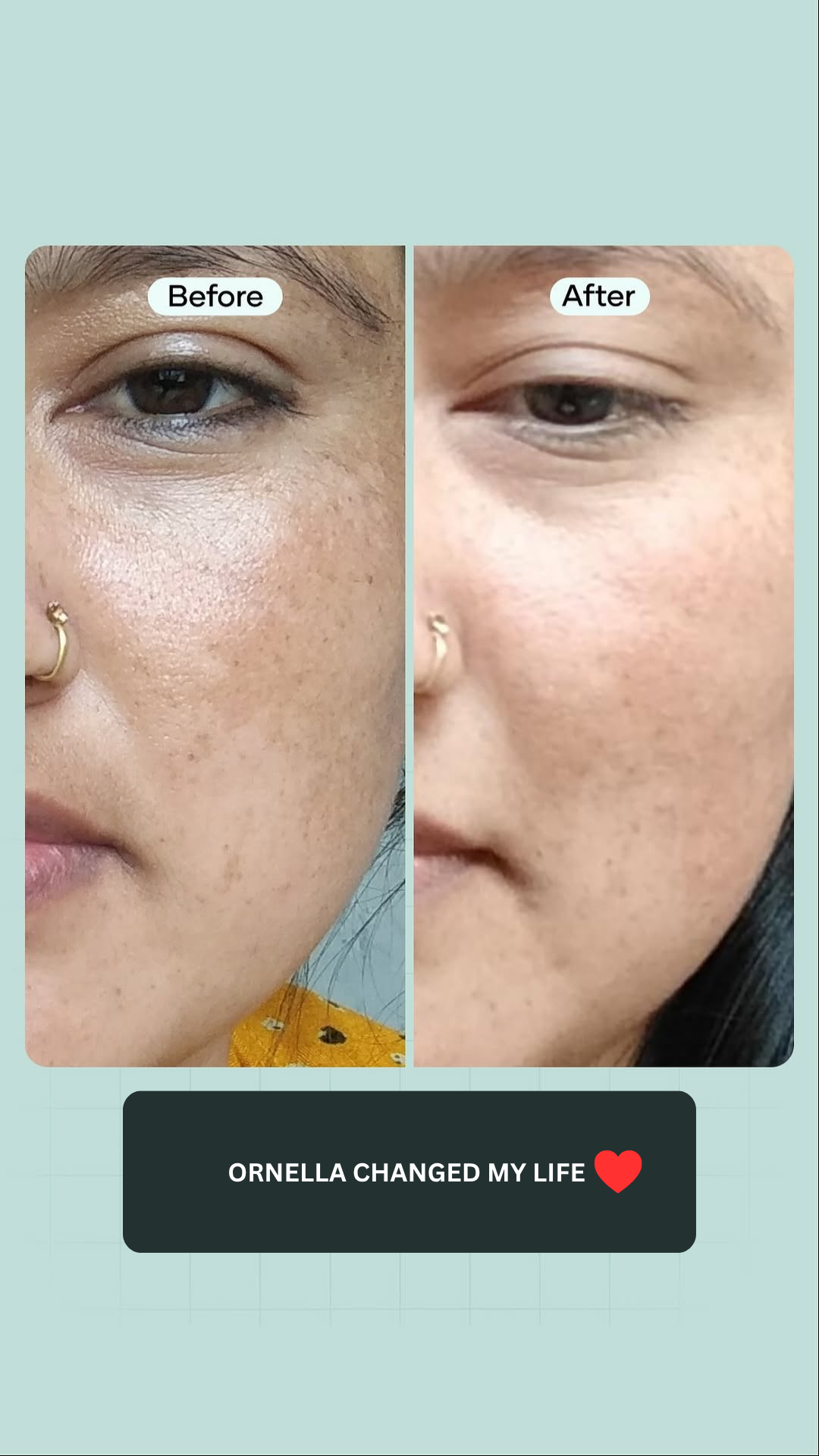 PORE MINIMISING BUNDLE  (PACK OF 4)