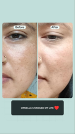 PORE MINIMISING BUNDLE  (PACK OF 4)
