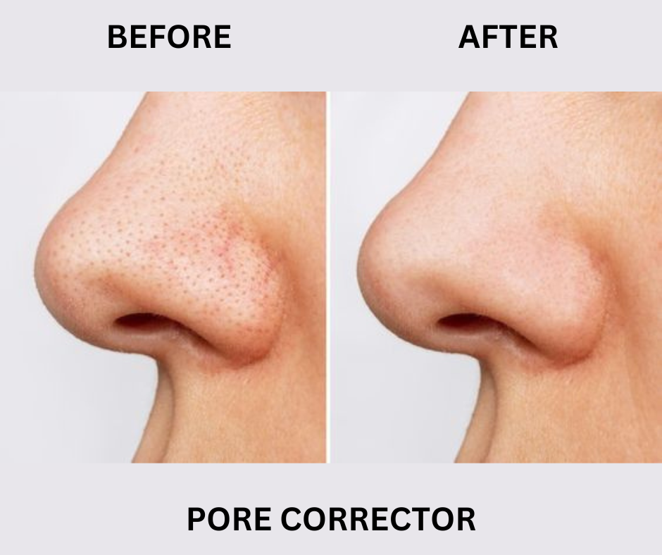 PORE CORRECTOR (Blackhead And Whitehead Solution)