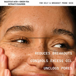 SALICYLIC ACID + GREEN TEA EXTRACTS ACNE CLEANSER (120 ml)