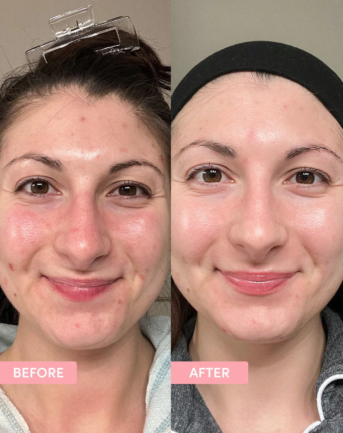 PORE MINIMISING BUNDLE  (PACK OF 4)