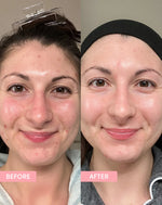 PORE MINIMISING BUNDLE  (PACK OF 4)