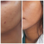 2% ALPHA ARBUTIN WHITENING SERUM (30 ml)