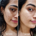 TEXTURE REDUCER BUNDLE(PACK OF 3)