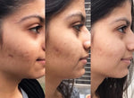 TEXTURE REDUCER BUNDLE(PACK OF 3)