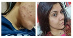 TEXTURE REDUCER BUNDLE(PACK OF 3)