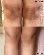 HAND & FEET WHITENING CREAM (100 gm)