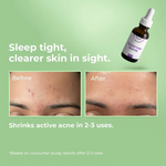 CLARIFYING ACNE SERUM (30 ml)