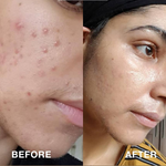PORE MINIMISING BUNDLE  (PACK OF 4)
