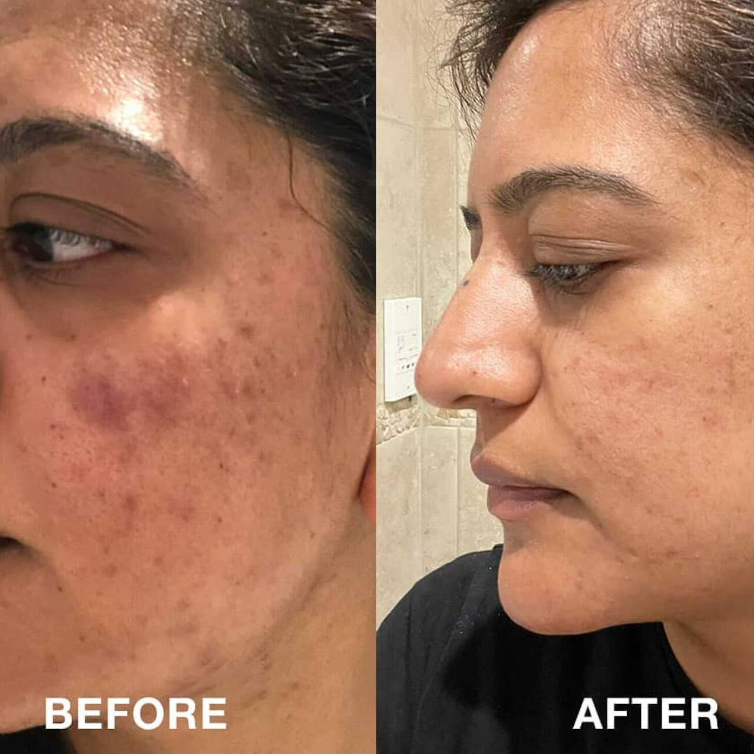 WHITE & BRIGHT BUNDLE (Pack of 3)