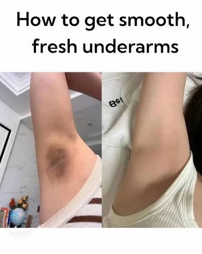 Ornella Glycolic Acid Toner + FREE D-Tan Cleanser