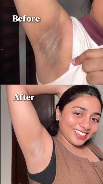 5% GLYCOLIC ACID + STRAWBERRY EXTRACTS EXFOLIATING CLEANSER (120 ml)