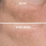 12% VITAMIN C BRIGHTENING SERUM (30 ml)