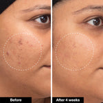 12% VITAMIN C BRIGHTENING SERUM (30 ml)