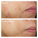 PORE MINIMISING BUNDLE  (PACK OF 4)