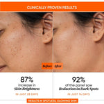 12% VITAMIN C BRIGHTENING SERUM (30 ml)
