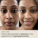 2% ALPHA ARBUTIN WHITENING SERUM (30 ml)
