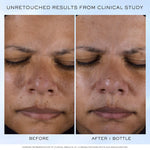 2% ALPHA ARBUTIN WHITENING SERUM (30 ml)