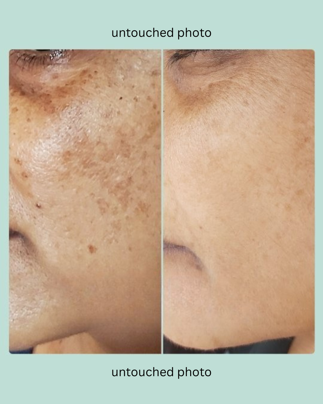 KOREAN GLASS SKIN BUNDLE (PACK OF 5)